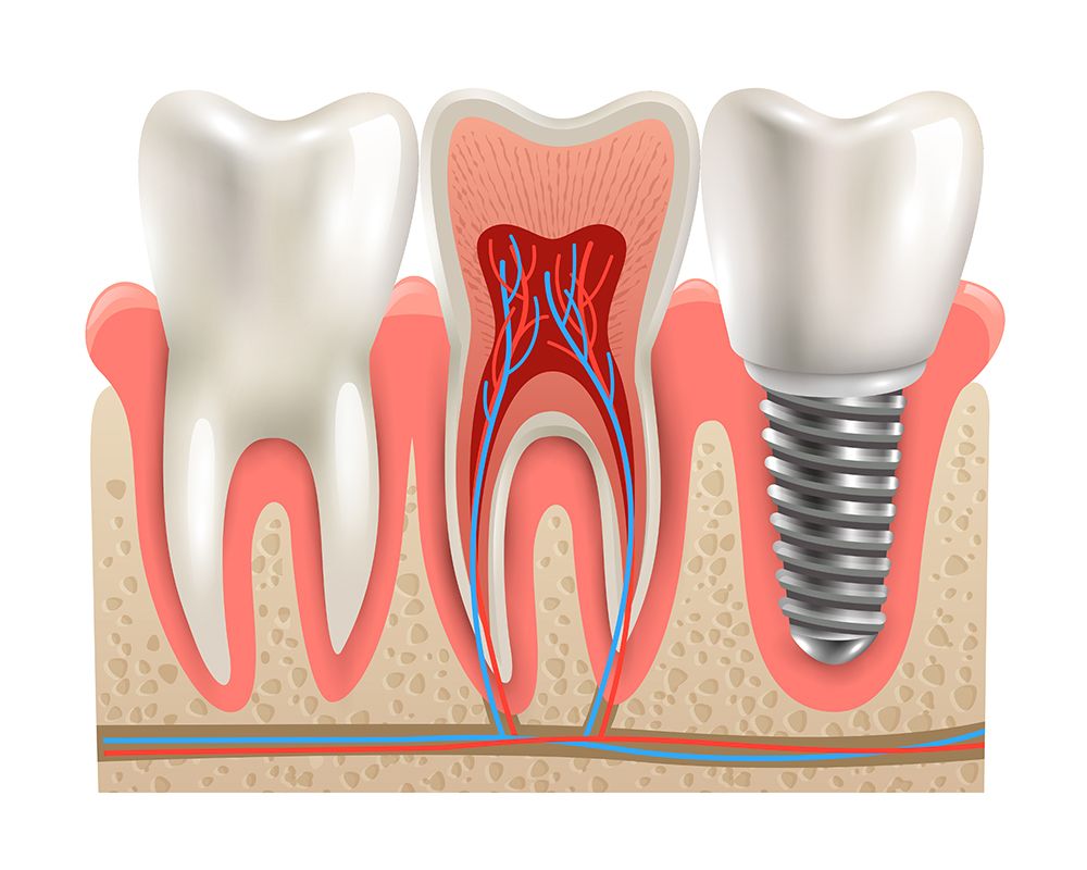 Endodontics 2 15064 21ecc54b