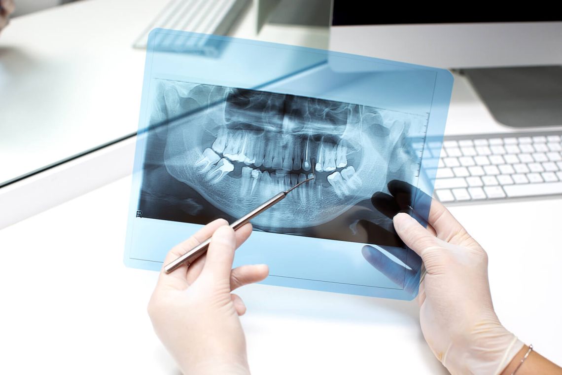 New Patients 20 dentist analyzes x ray photo 2 3aa9921b
